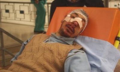 Osmancık’ta Kaza: Zihinsel Özürlüye Çarptı