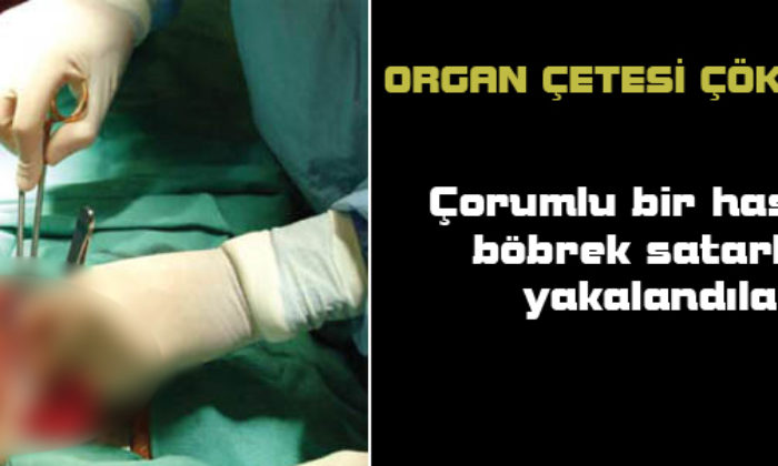 Organ Ticareti Yapan Çete Çökertildi