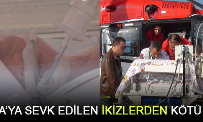 İkizler Hayata Tutunamadı