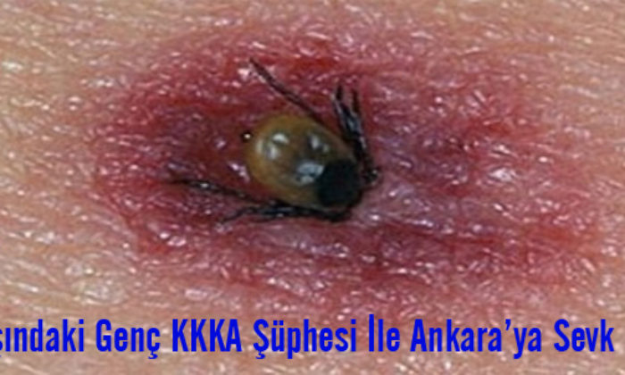 Bacağını Yapışan Keneyi Kendisi Çıkardı