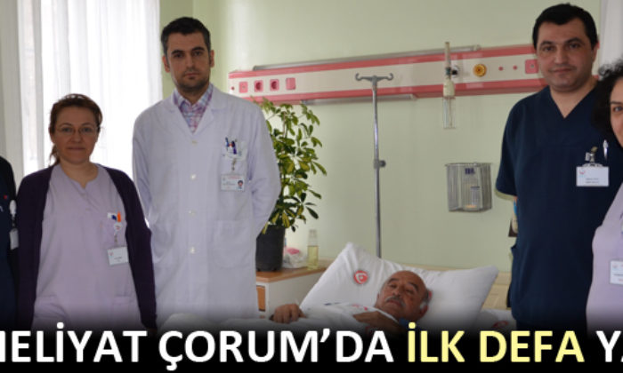 Bu Ameliyat Çorum’da İlk Defa Yapıldı