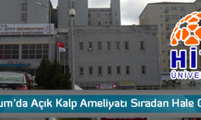 “Çorum’da Açık Kalp Ameliyatı Sıradan Hale Geldi”