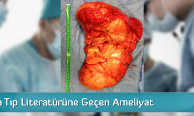Çorum’da Tıp Literatürüne Geçen Ameliyat