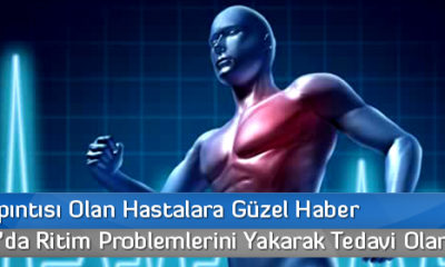 Kalp Çarpıntısı Olan Hastalara Güzel Haber
