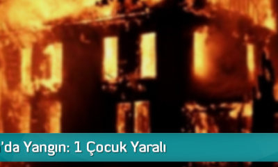 Dodurga’da Yangın: 1 Çocuk Yaralı