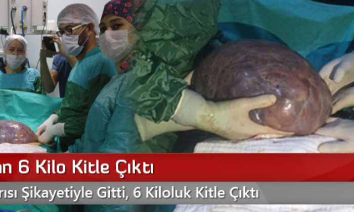 Karnından 6 Kilo Kitle Çıktı
