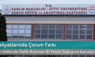 Kalp Ameliyatlarında Çorum Farkı