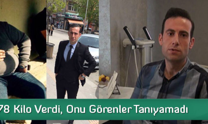 78 Kilo Verdi, Görenler Tanıyamadı