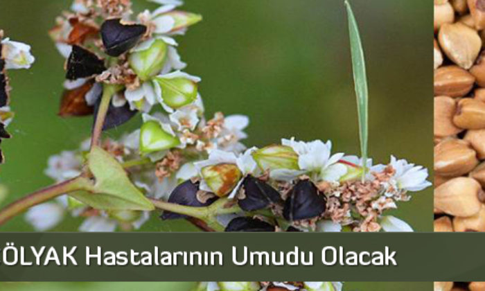 Çorum, ÇÖLYAK Hastalarının Umudu Olacak