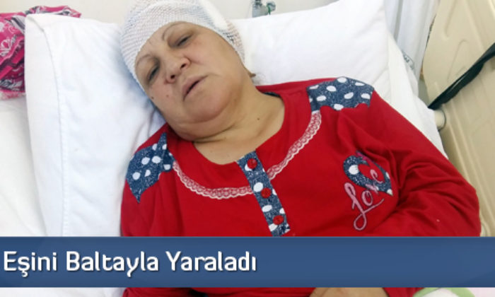 Tartıştığı Eşini Baltayla Yaraladı