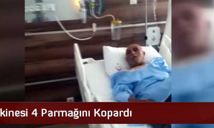 Patos Makinesi 4 Parmağını Kopardı