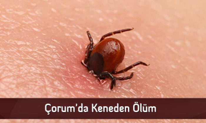 Çorum’da Keneden Ölüm