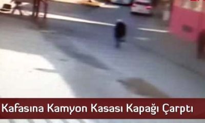 Kafasına Kamyon Kasası Kapağı Çarptı