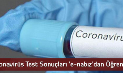 Koronavirüs Test Sonuçları ‘e-nabız’dan Öğrenilecek