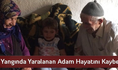 Yangında Yaralanan Adam Hayatını Kaybetti