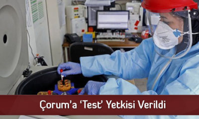 Çorum’a ‘Test’ Yetkisi Verildi
