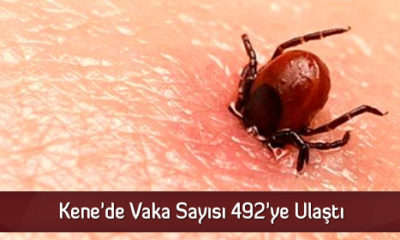 Kene’de Vaka Sayısı 492’ye Ulaştı