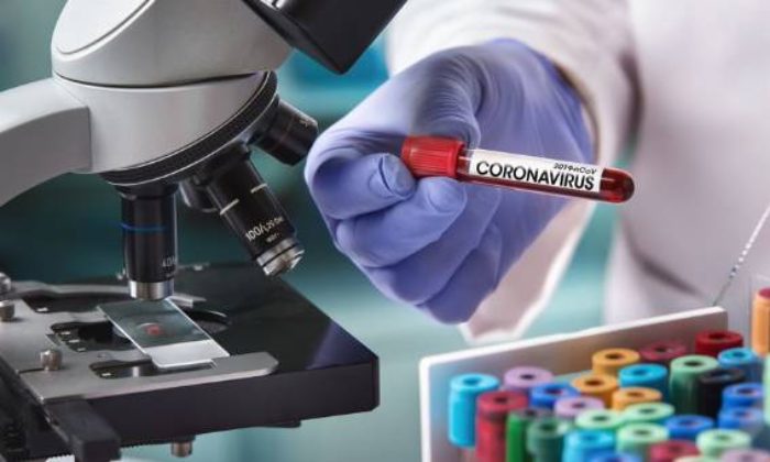 Anne ve Bebeği Covid-19’dan Öldü