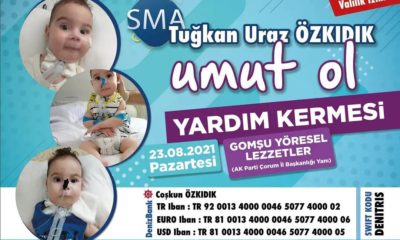 Tuğkan Bebek Çorumlulardan Destek Bekliyor