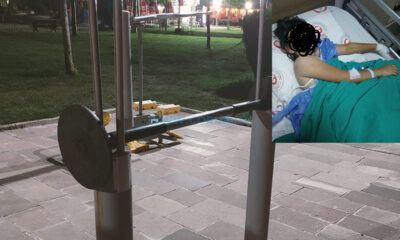 Parkta Oynayan 7 Yaşındaki Çocuğun Parmağı Koptu