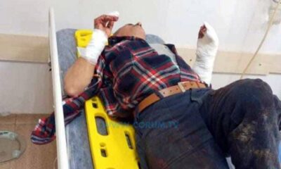 Kendisine Saldıran Domuzu Bıçakla Etkisiz Hale Getirdi